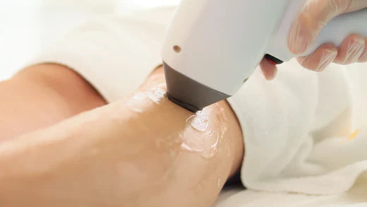 Faut-il choisir l'épilation laser ? Avantages et limites